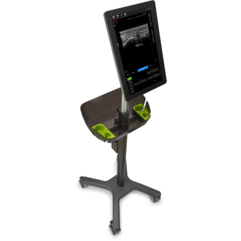 彩色超声诊断系统